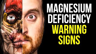 10 Signs of Magnesium Deficiency to Never Ignore