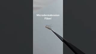 Skin Cells on a Microdermabrasion Filter!