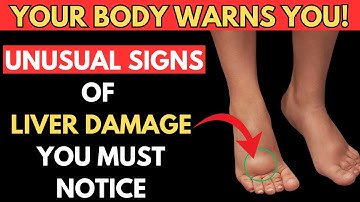 10 Strange Signs Your Liver Is In Trouble (Don’t Ignore These!)
