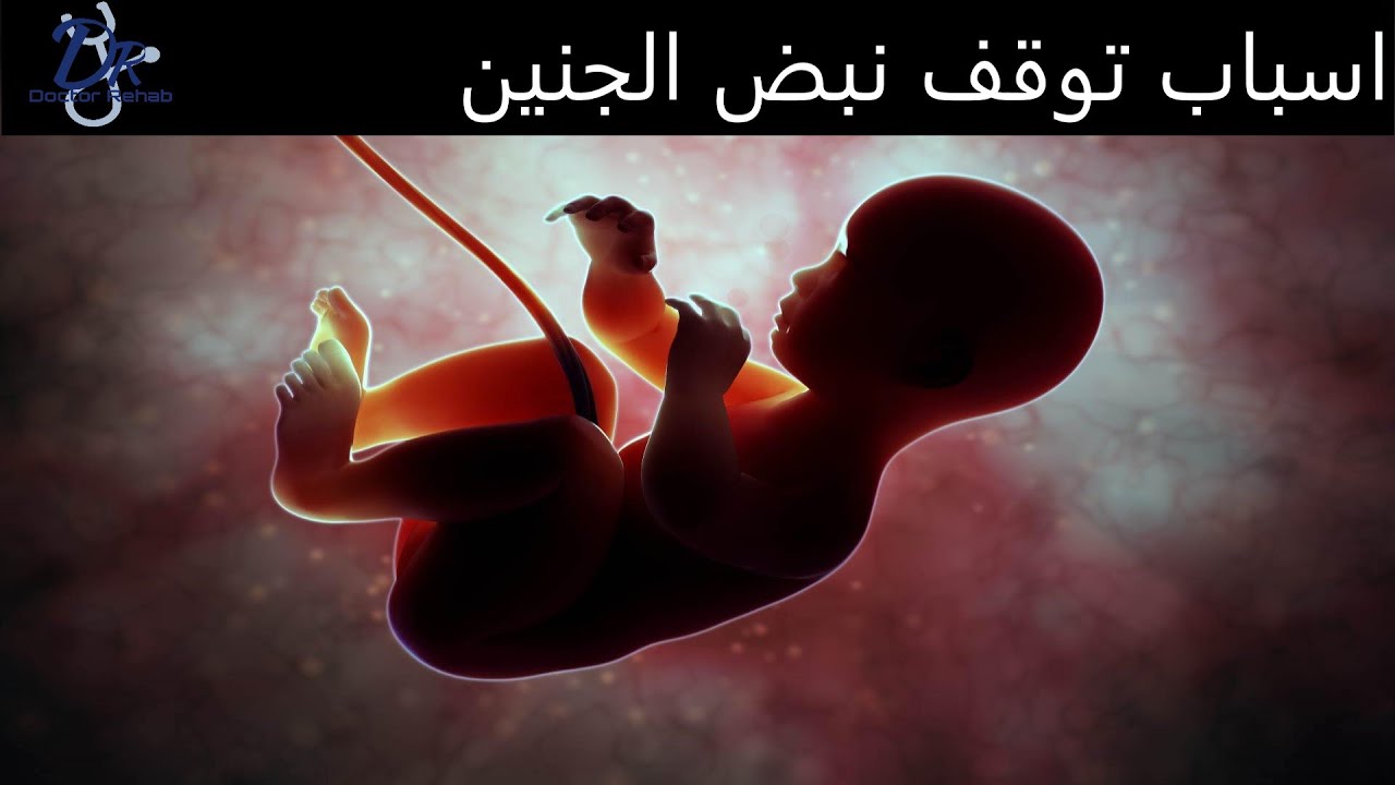 أسباب توقف نبض الجنين