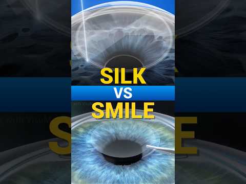 SILK V/S SMILE