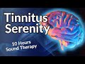 Tinnitus Serenity Sound Therapy Relief That WORKS 