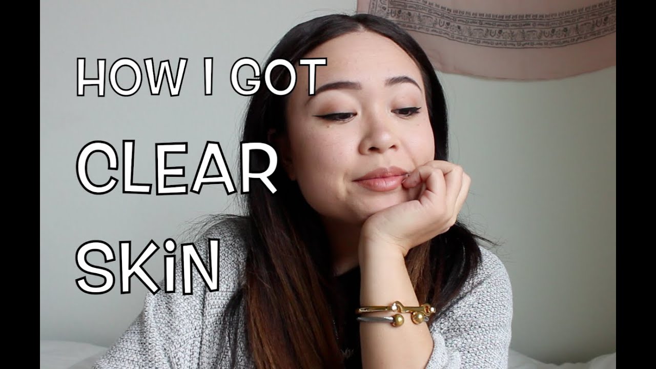 How I Got Clear Skin - YouTube