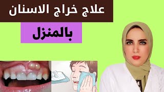 هذه الطريقه تقضي علي خراج الوجه والضرس بسرعه جدا اسباب وعلاج خراج الاسنان