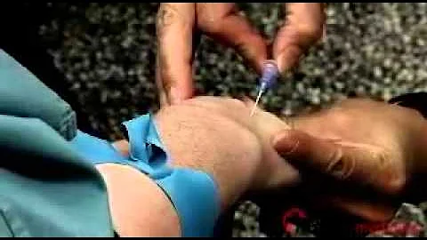 Insidermedicine In Depth - January 25, 2012 - 天天要闻