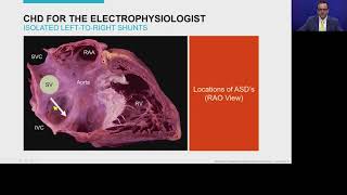 ECGs in Patients With Adult Congenital Heart Disease - Part I