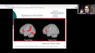 IDA Massachusetts Presents: Dyslexia 101: Understanding Dyslexia