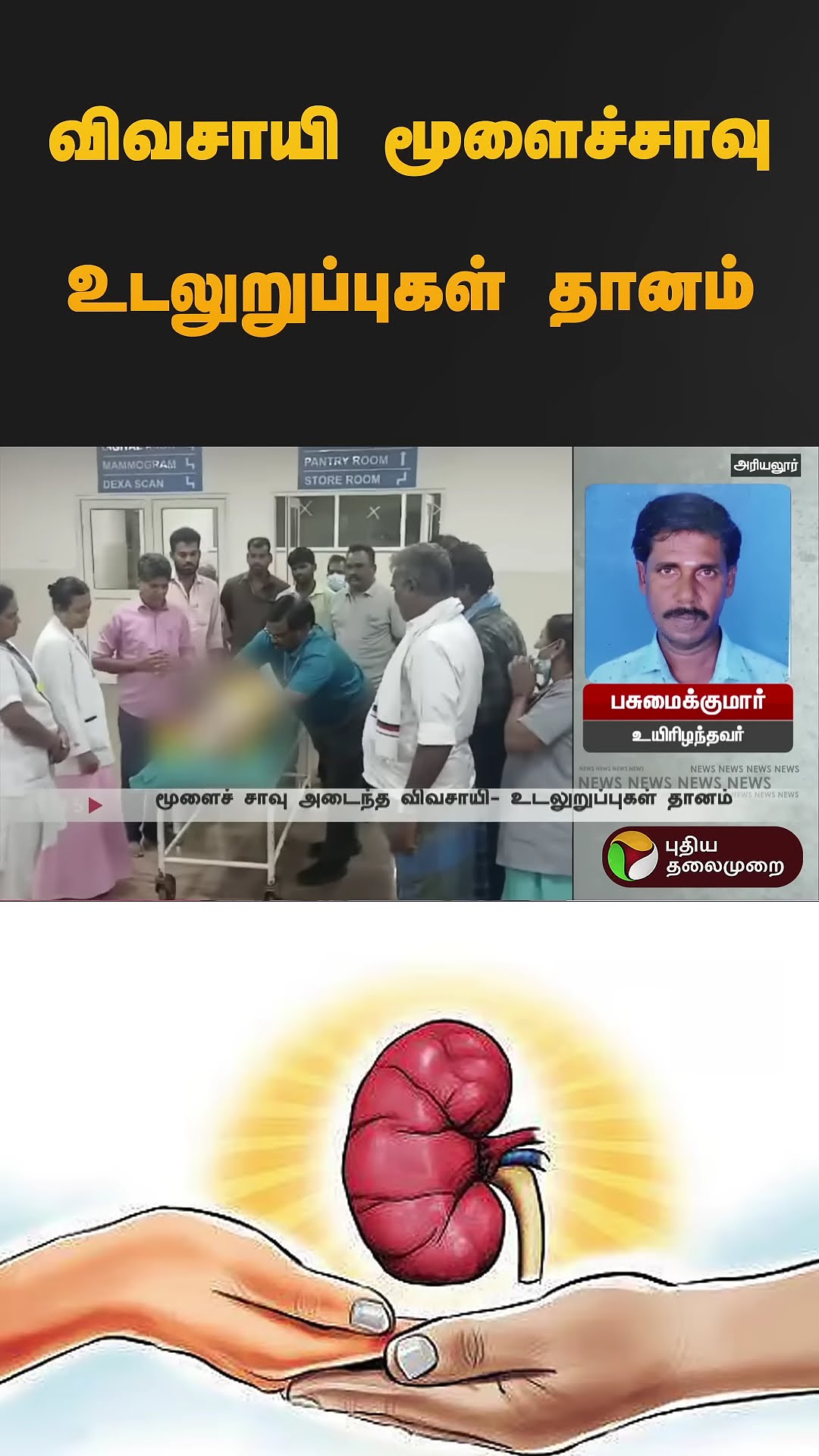 விவசாயி மூளைச்சாவு  உடலுறுப்புகள் தானம் | #ariyalur | #farmer | #braindead | #shorts