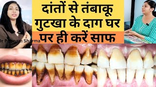 दांतो से तम्बाकू गुटखा के दाग घर पे ही कैसे साफ़ करे |  How To Remove Tobacco  Stains from Teeth |