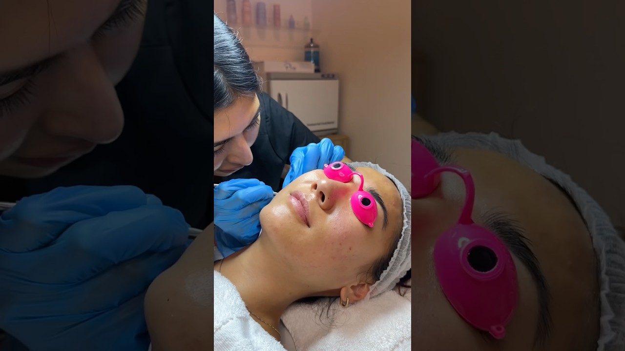 extraction facials for congested skin 