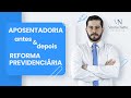 Diferença da aposentadoria antes da reforma e depois da reforma
