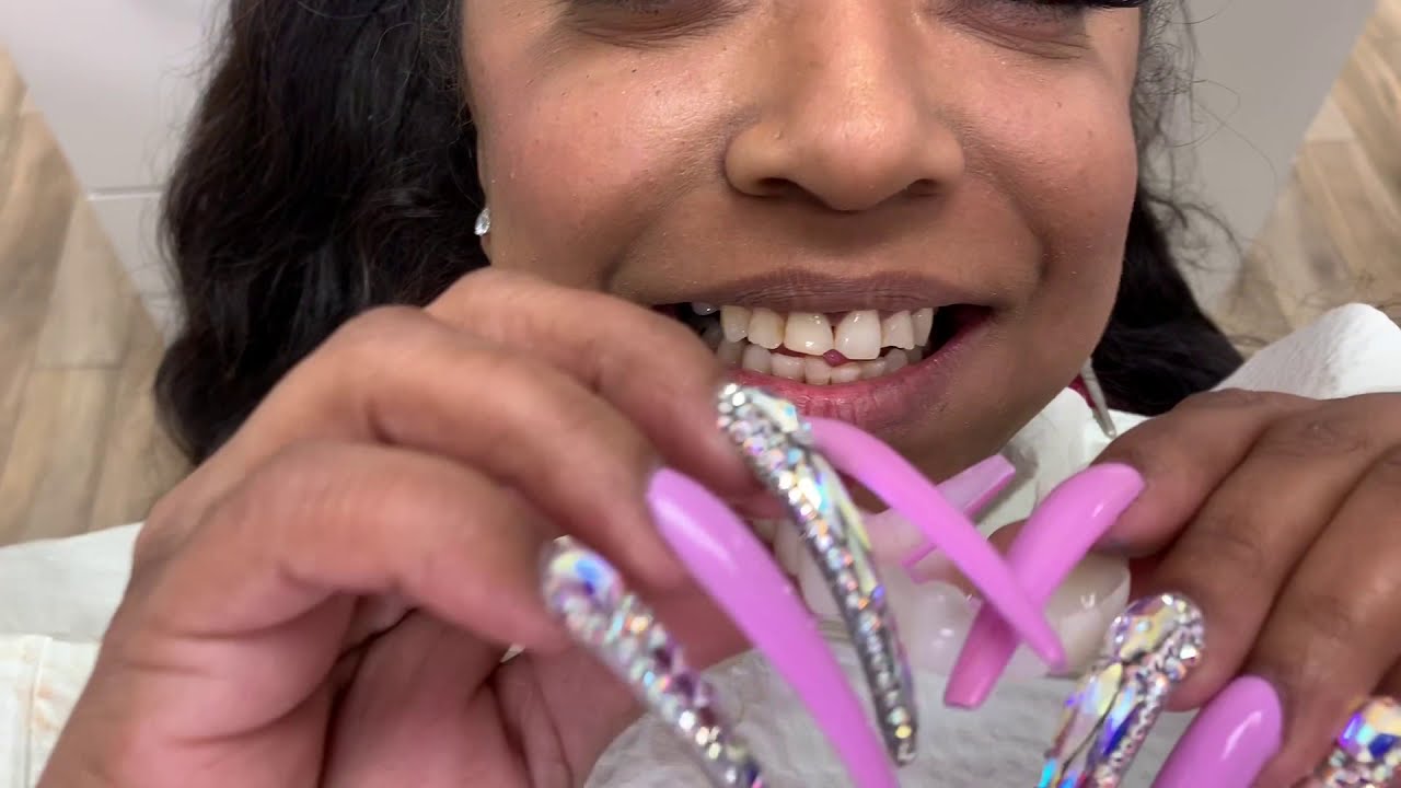 Houston Cosmetic Dentist..Snapon Smile and the Longest Nails Ever
