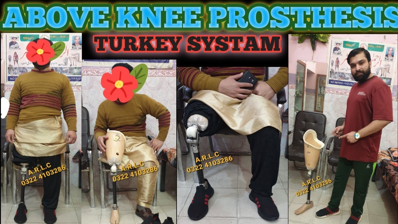 Above knee prosthesis imported Turkey systam 