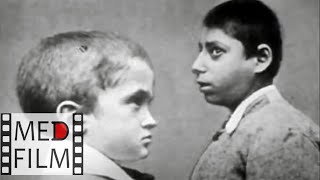 Как Определить Шизофрению У Детей? © Schizophrenia In Children - How To Identify?