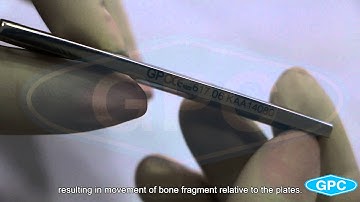 Small DCP Plates | Small Fragment Implants | DCP Plates Manufacturer