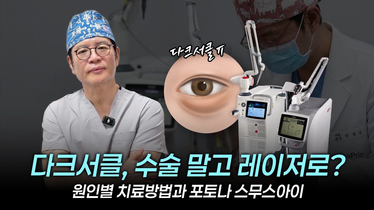 다크서클, 수술 말고 레이저로?! 포토나 스무스아이로 해결! (원인별 치료방법) #스무스아이 #라프린의원 #포토나레이저