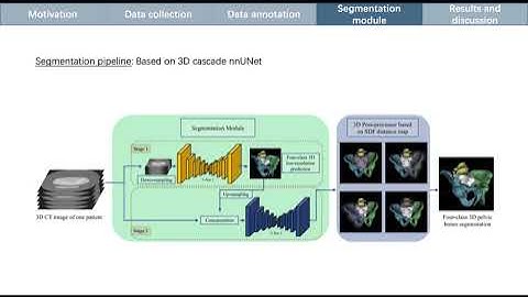 IPCAI 2021 #07 - Deep Learning to Segment Pelvic Bones: Large-scale CT Datasets and Baseline Models
