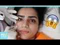 4 facial hair removal methods | Positive