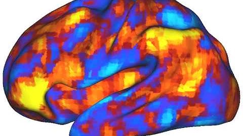 spontaneous brain activity (i)