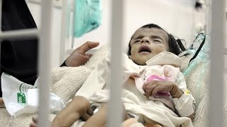 Yemen'de yarım milyon çocuk ölüm tehlikesiyle karşı karşıya Resimi