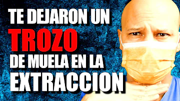 ¿Qué ocurre si queda un poco de raíz después de la extracción?