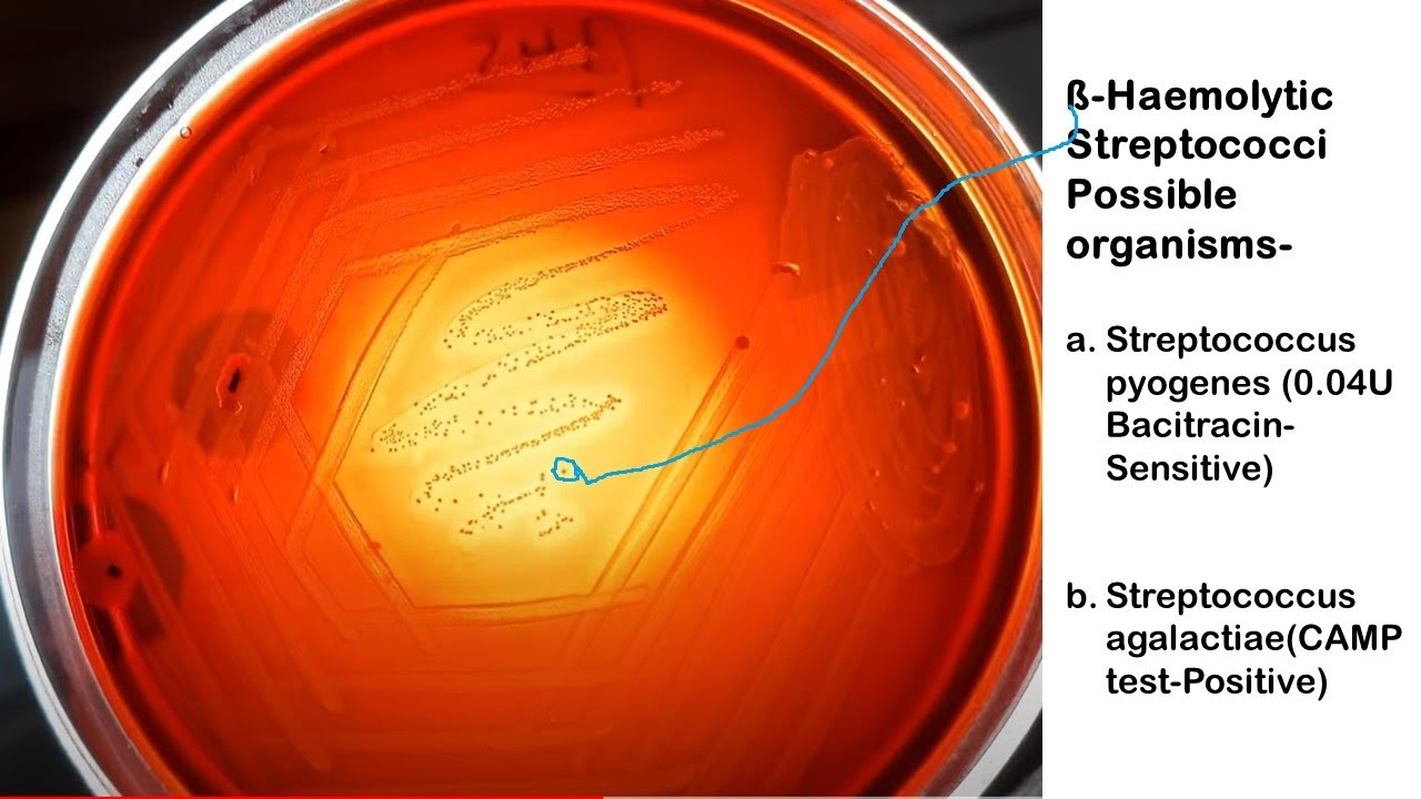 Beta haemolytic Streptococci On Blood Agar YouTube Beta haemolytic Streptococci On Blood Agar YouTube