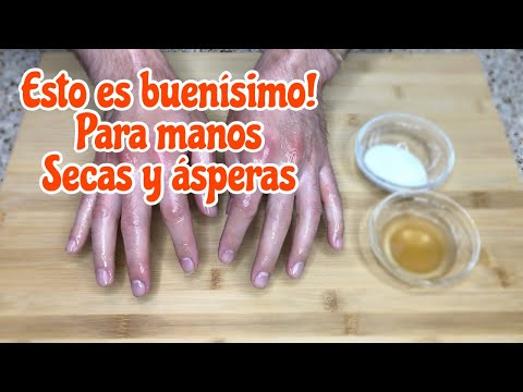 Video: Cómo tratar las manos agrietadas y callosas (con imágenes)