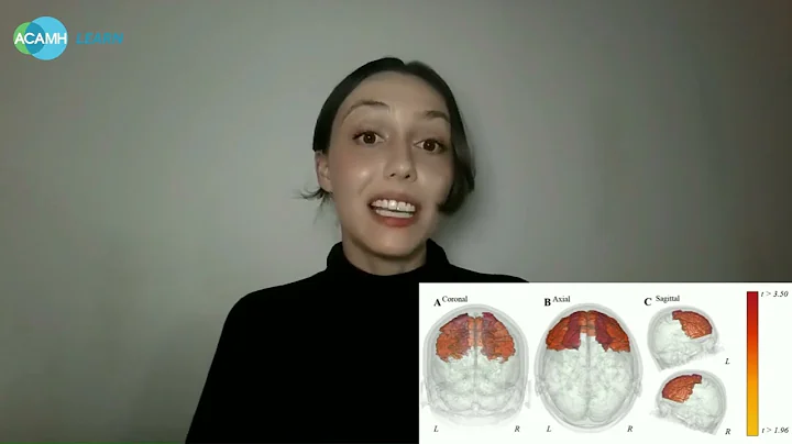 Neural Correlates of Children with Avoidant Restrictive Food Intake Disorder (ARFID) Symptoms