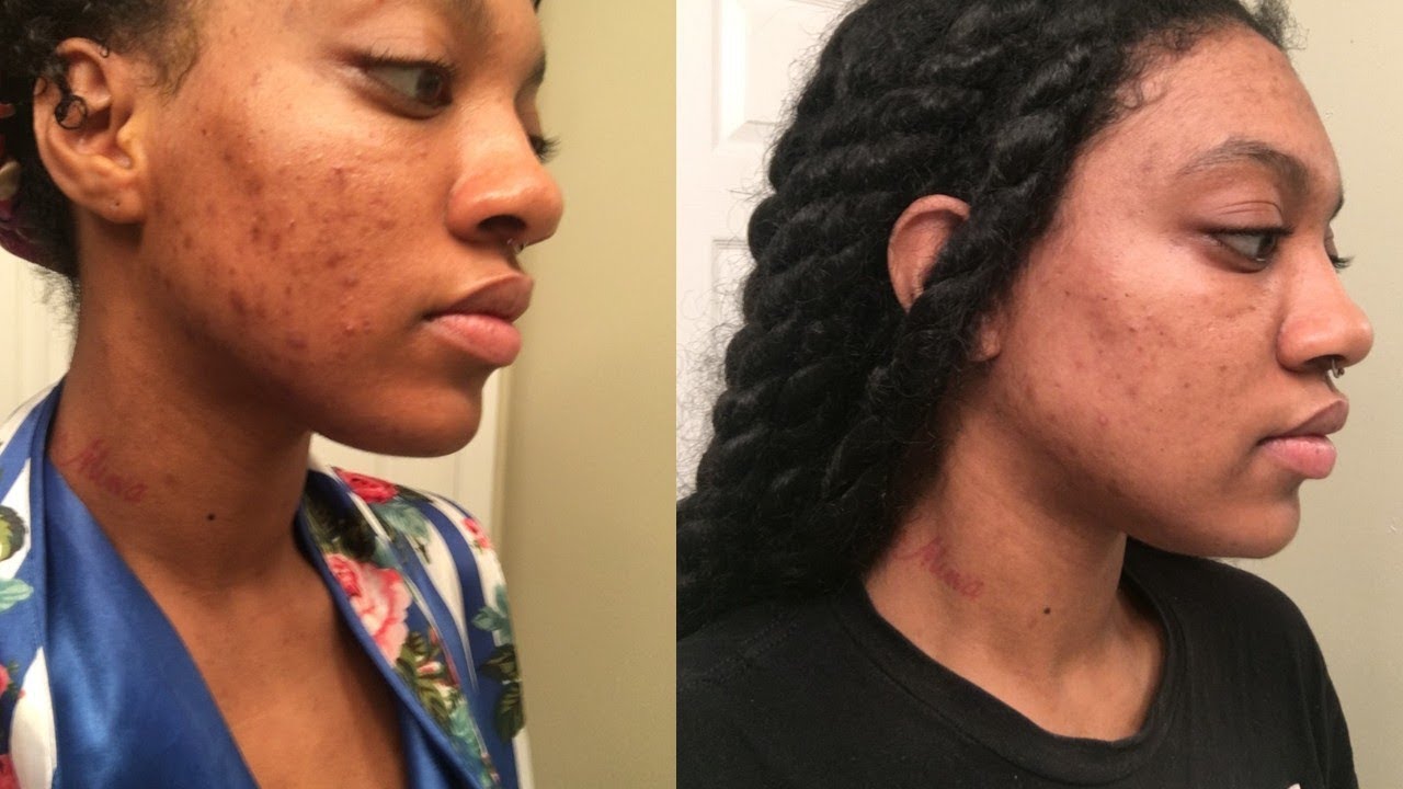 get-rid-of-dark-spots-fast-with-coffee-diy-coffee-srcub-styledbykami