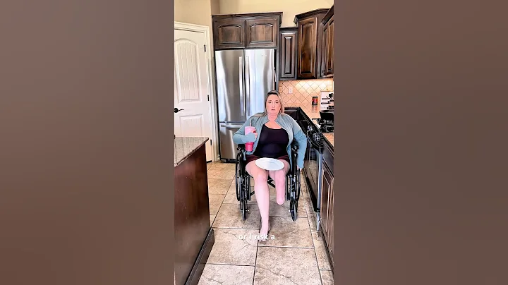 Below the knee amputee can’t wear prosthetic leg