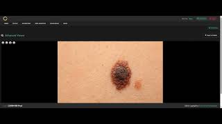 How to Upload Clinical Photos & Compare Images Side-by-Side in CIM