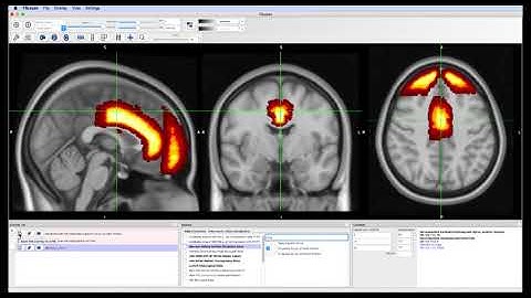 Using FSLeyes, Part 4: Atlases and ROI Drawing