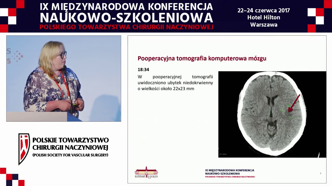 PTChN 2017 E. Swiecka (dzień 3, wykład 16)