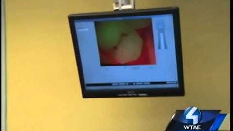 Spectra Caries Device Featured on WTAE, Pittsburgh