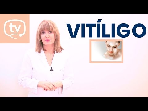Causas, síntomas y tratamientos del vitíligo