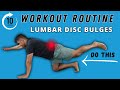 Beginner workout for lumbar disc bulges for immediate pain relief