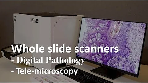 Optimus 6T - Whole Slide Scanner Demo - Digital Pathology Workflow for Tele-pathology, Archival & AI