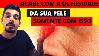 [Tutorial] Maizena E Soro Fisiológico Para Eliminar A Oleosidade Da Pele