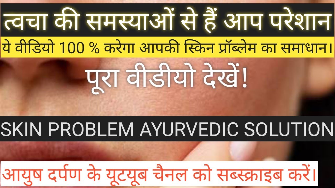 स्किन /त्वचा रोगों से हैं परेशान तो जरूर देखें यह वीडीयो