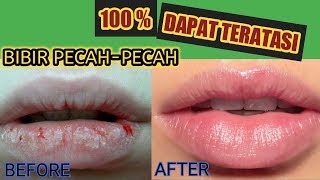 CARA MENGHILANGKAN BIBIR PECAH PECAH DAN KERING