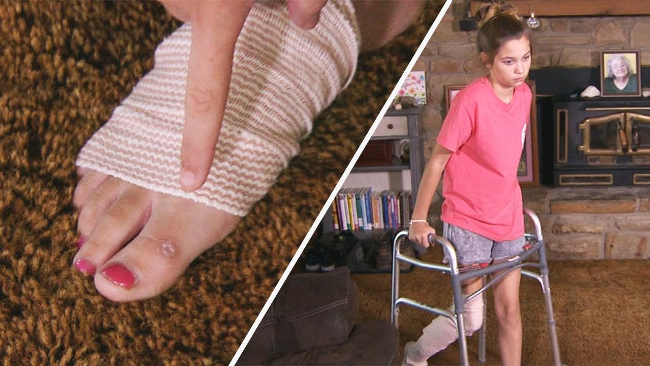 How 12-Year-Old Contracted Flesh-Eating Bacteria - Inside Edition thumbnail