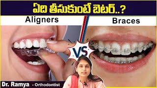 Aligners ఎప్పుడు తీసుకోవాలి || Clear Aligners Vs Braces - Which is Best || Eledent Dental Hospitals screenshot 5