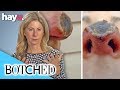 Kelly Removed Her Own Skin Cancer Using Black Salve! | Botched