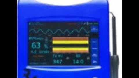 ExSpiron: Setting up a Monitoring Session