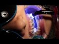 شاهد كيف يتم وضع تقويم الاسنان مع د.مصطفي اسامه see how we put dental braces