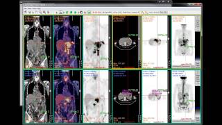 Unisyn Study Comparison