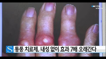 통풍 치료제, 부작용 없이 효과 7배 늘린다 / YTN 사이언스