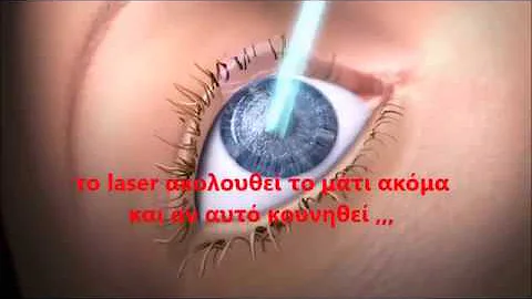 LASIK-  , myopia-laser-tsi...