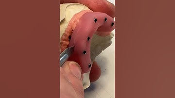 Creating a Verification Jig #fullmouthdentalimplants #dentist #dental #smiledental #teeth