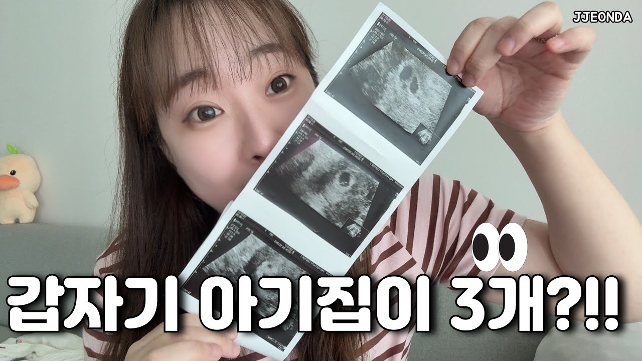 시험관브이로그:: 걱정이 만든 반전, 쌍둥이 등장!! (임밍아웃 난임브이로그 임신준비 ivf 난임병원 쌍둥이임신 일상브이로그 vlog)